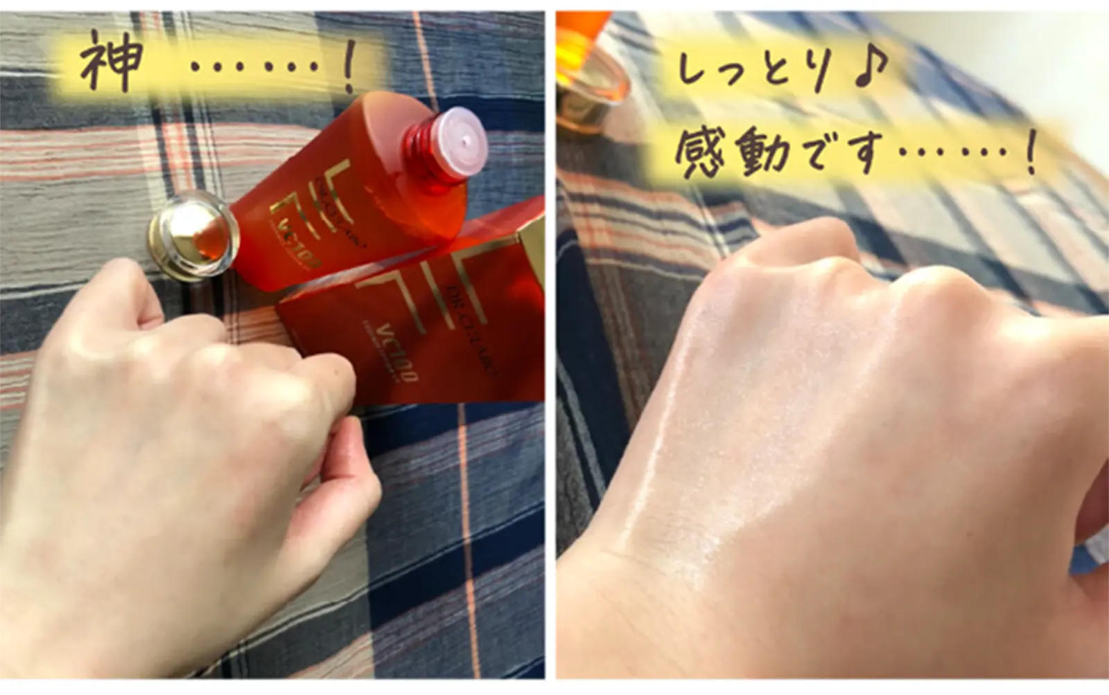 手