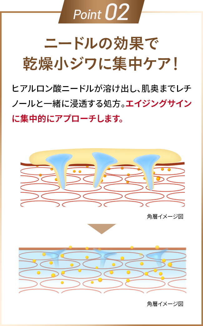 Point02 ニードルの効果で乾燥小ジワに集中ケア！ヒアルロン酸ニードルが溶け出し、肌奥までレチノールと一緒に浸透する処方。エイジングサインに集中的にアプローチします。