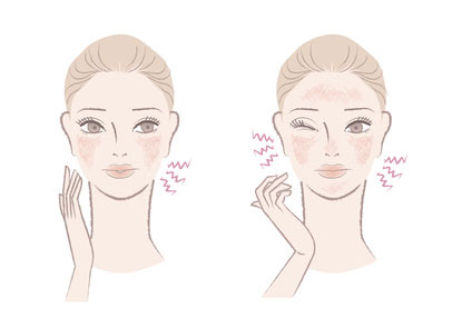 肌のヒリつきを感じている女性のイラスト