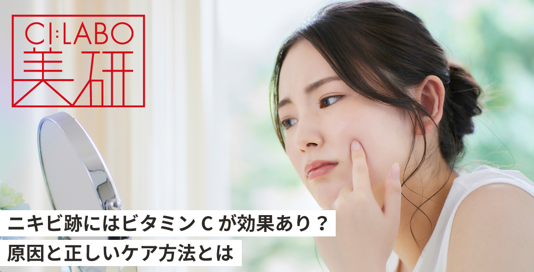 ニキビ跡にはビタミンCが効果あり？原因と正しいケアとは