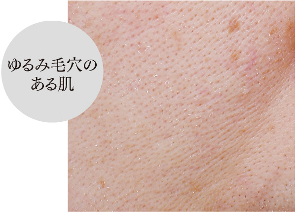 ゆるみ毛穴のある肌 ゆるみ毛穴のある肌