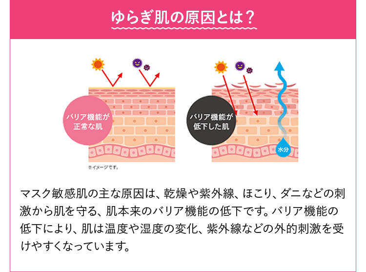 ゆらぎ肌の原因とは？マスク敏感肌の主な原因は、乾燥や紫外線、ほこり、ダニなどの刺激から肌を守る、肌本来のバリア機能の低下です。バリア機能の低下により、肌は温度や湿度の変化、紫外線などの外的刺激を受けやすくなっています。