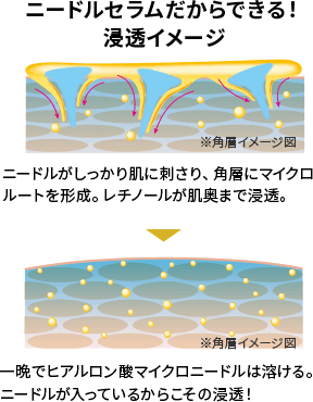 ニードルセラムだからできる!浸透イメージ ニードルがしっかり肌に刺さり、角層にマイクロルートを形成。レチノールが肌奥まで浸透。 一晩でヒアルロン酸マイクロニードルは溶ける。ニードルが入っているからこその浸透!