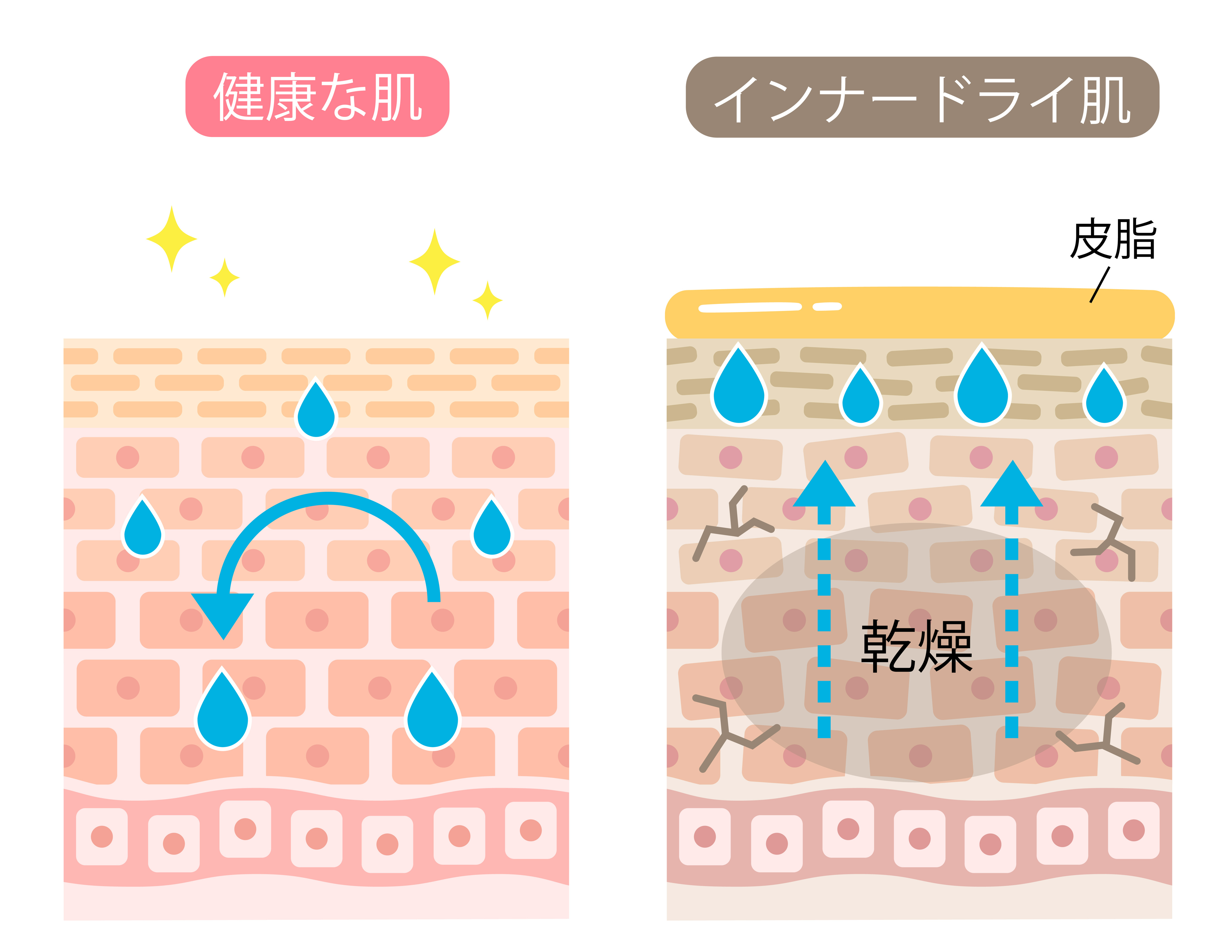 健康な肌　インナードライ