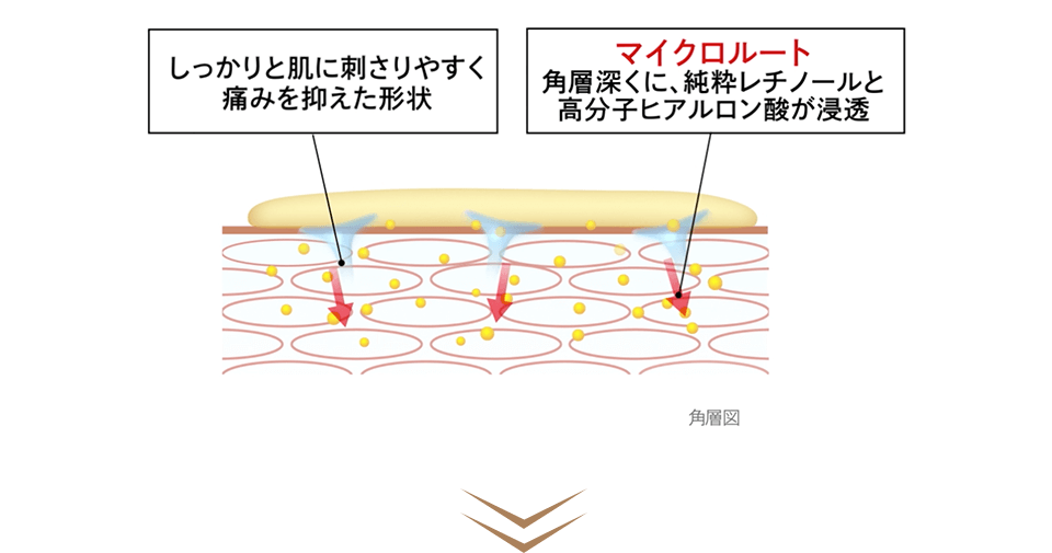 角層図　しっかりと肌に刺さりやすく痛みを抑えた形状　マイクロルート：角層深くに、純粋レチノールと高分子ヒアルロン酸が浸透