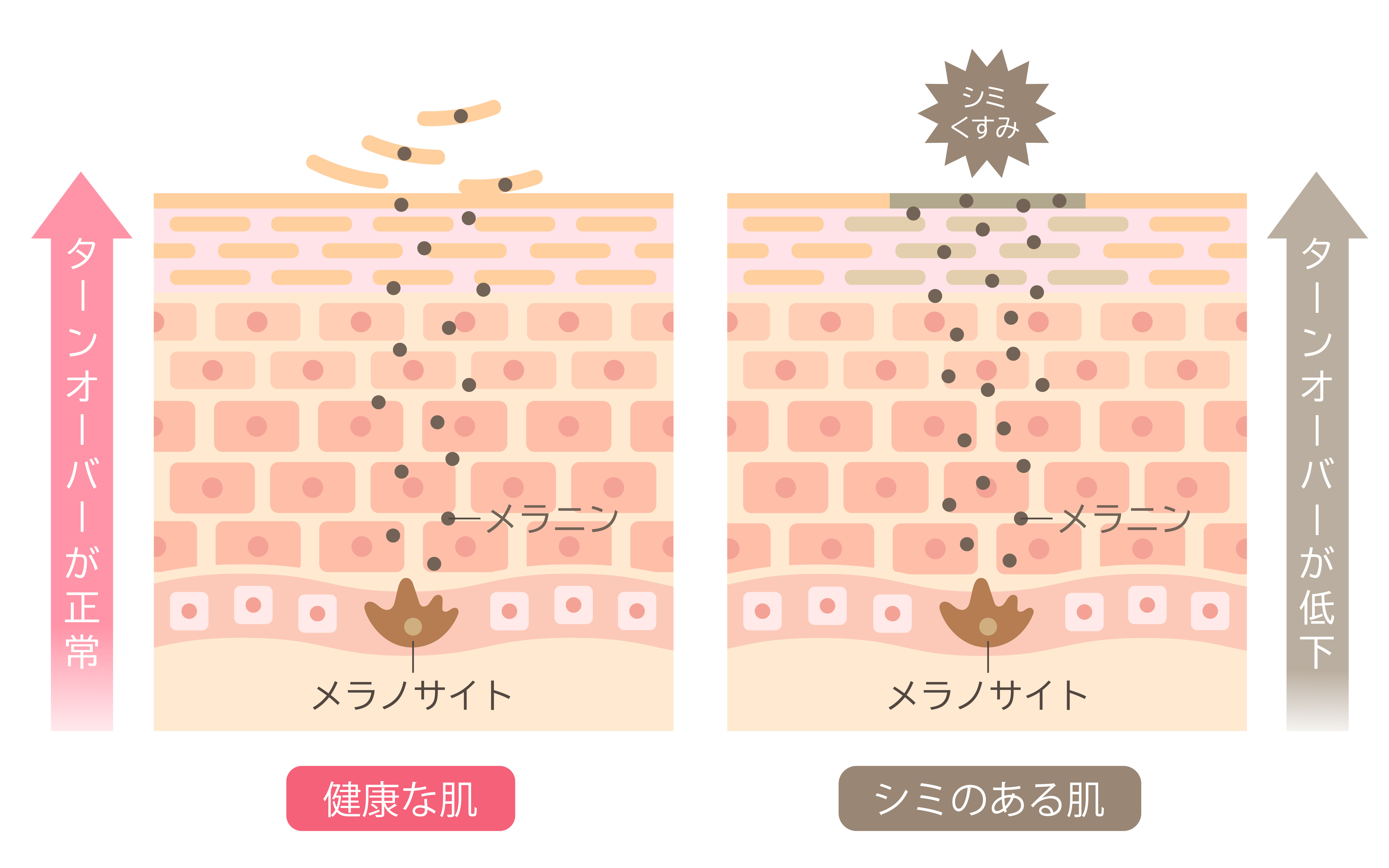 健康な肌：ターンオーバーが正常、シミのある肌：ターンオーバーが低下
