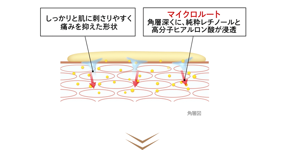 角層図 しっかりと肌に刺さりやすく痛みを抑えた形状 マイクロルート:角層深くに、純粋レチノールと高分子ヒアルロン酸が浸透