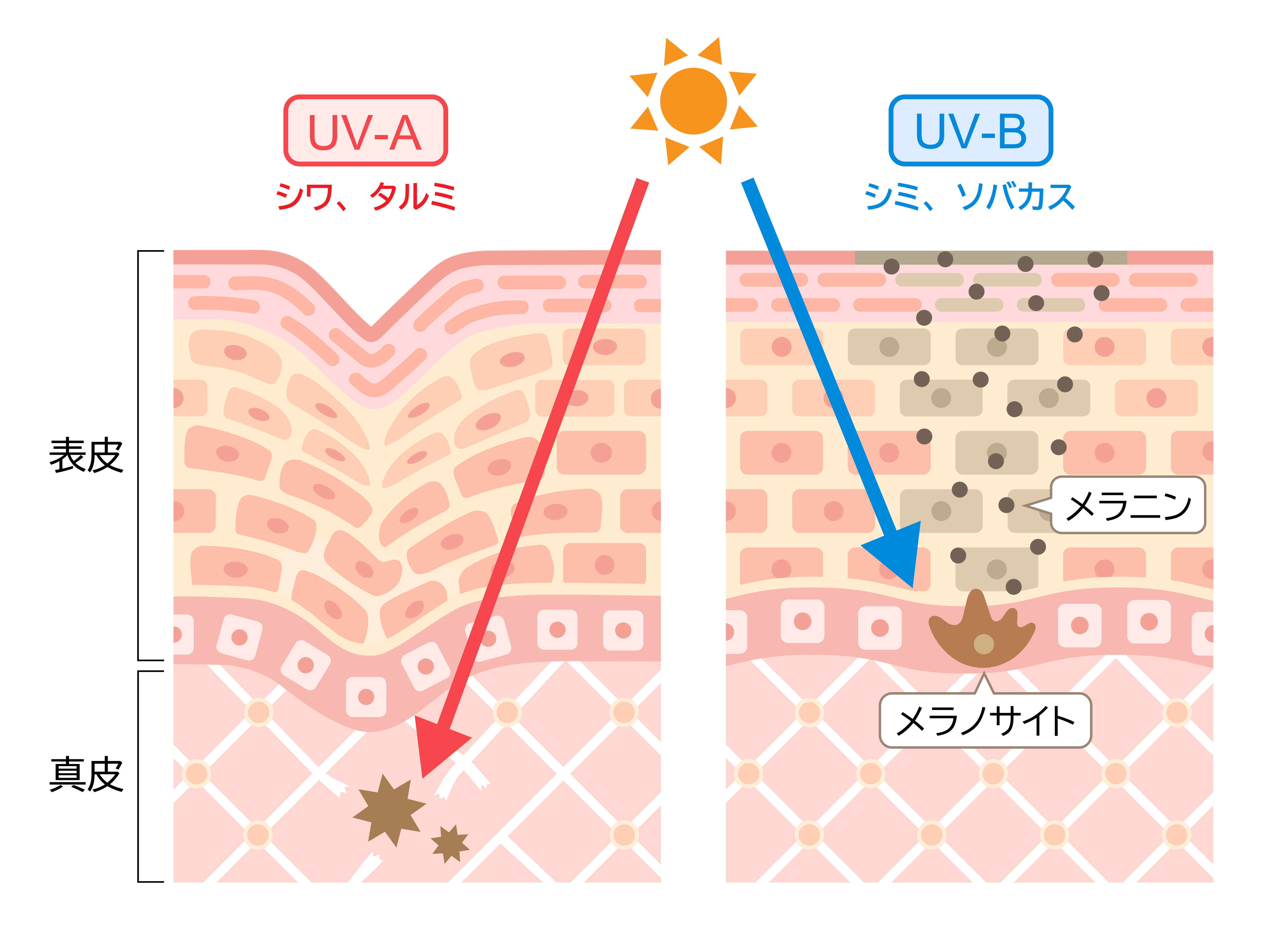 UV-A シワ、たるみ UV-B シミ、そばかす