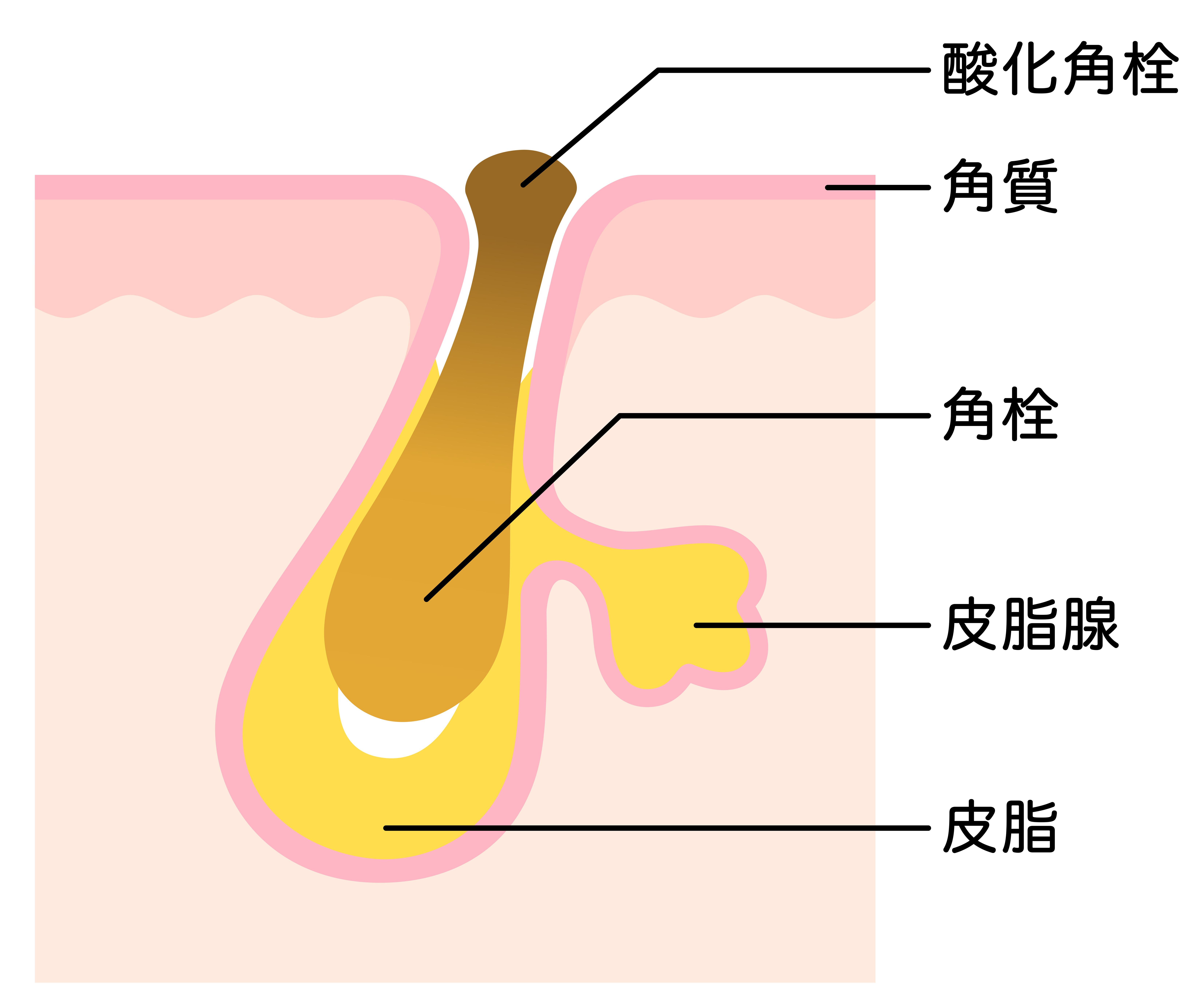角栓　図