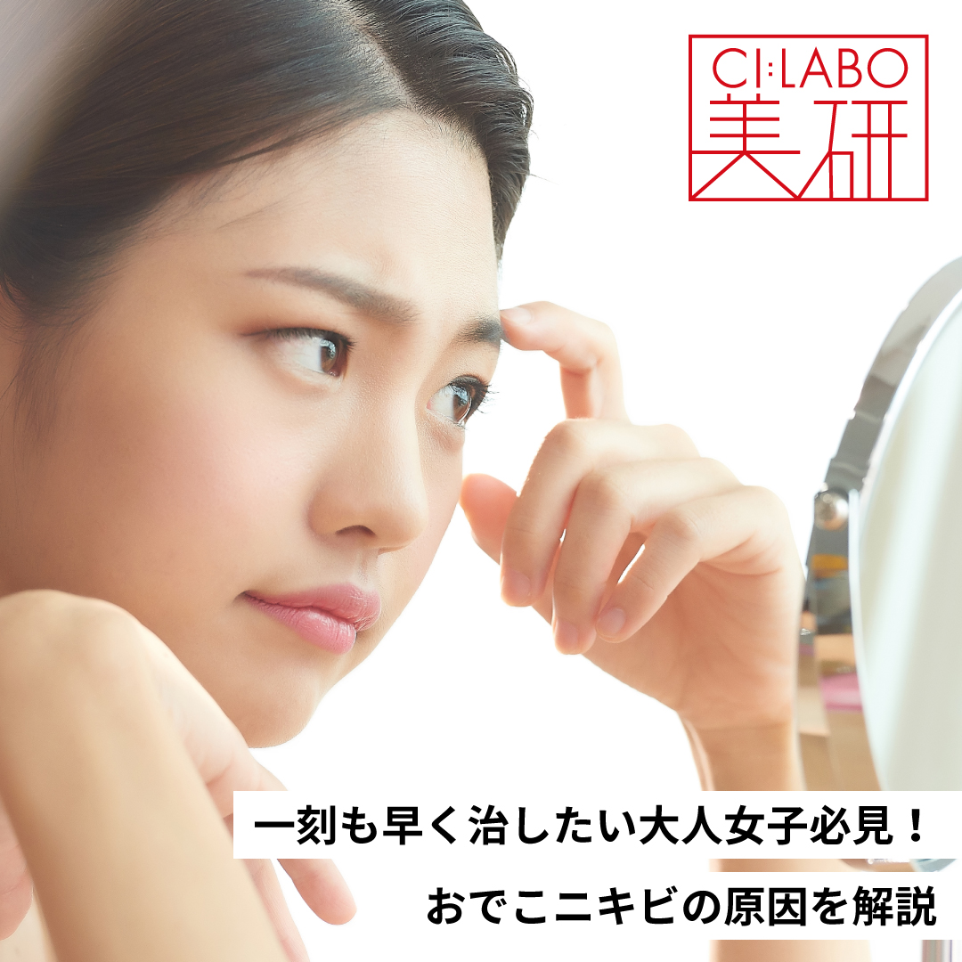 繰り返しできるおでこのニキビ。原因を解説
