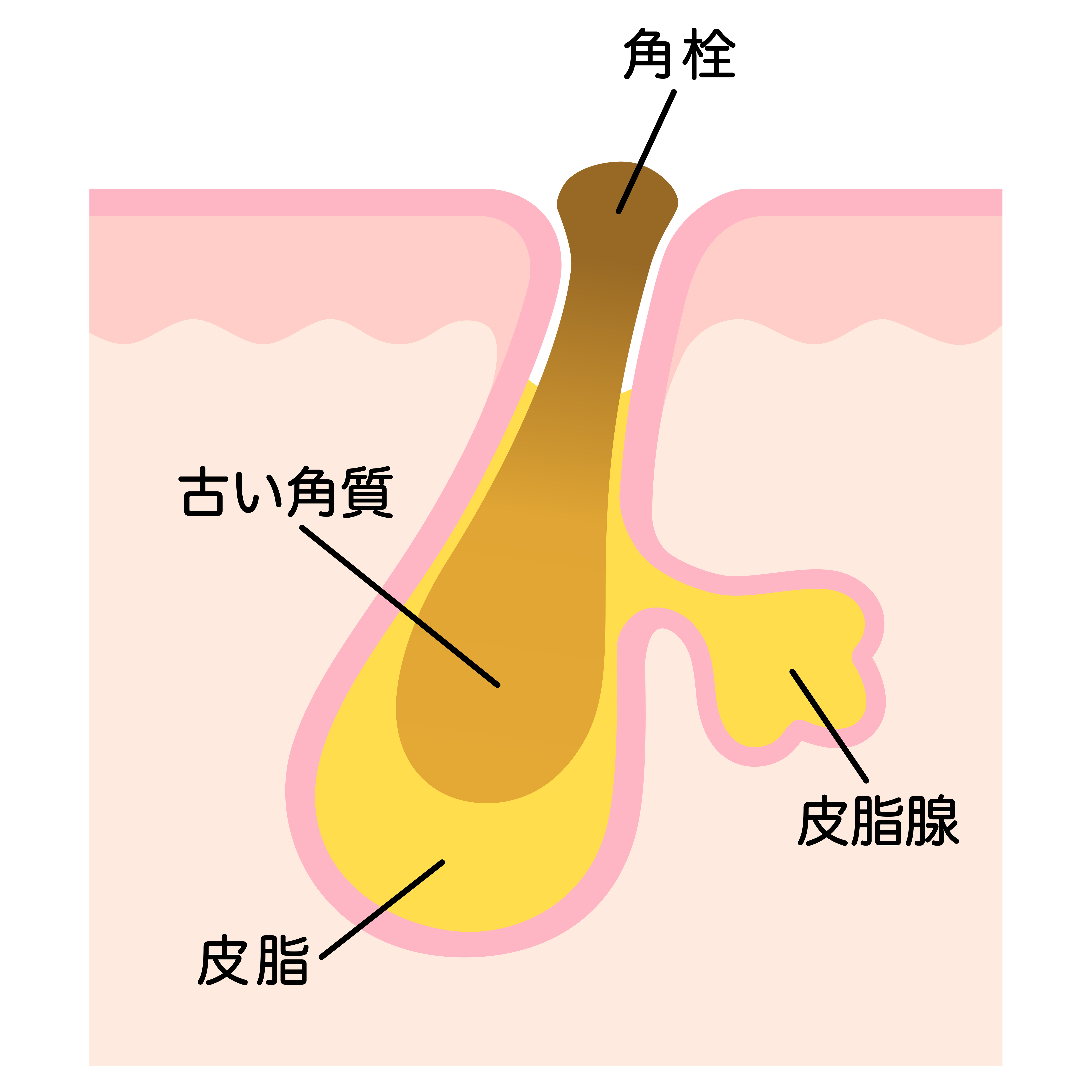 角栓の酸化