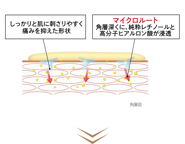 角層図 しっかりと肌に刺さりやすく痛みを抑えた形状 マイクロルート:角層深くに、純粋レチノールと高分子ヒアルロン酸が浸透