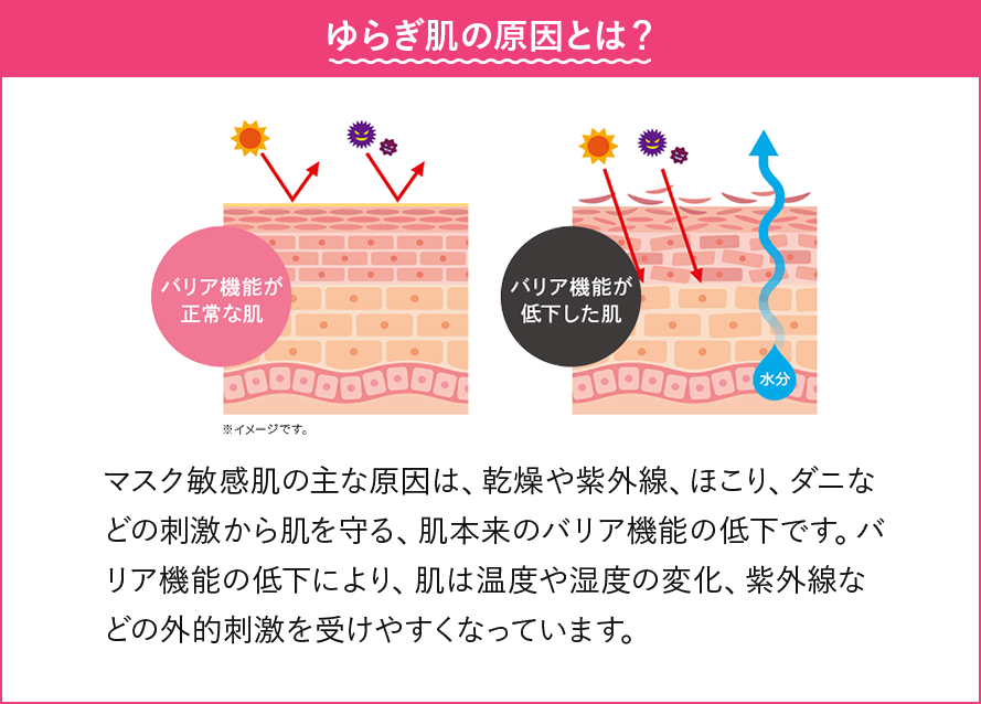 ゆらぎ肌の原因とは？マスク敏感肌の主な原因は、乾燥や紫外線、ほこり、ダニなどの刺激から肌を守る、肌本来のバリア機能の低下です。バリア機能の低下により、肌は温度や湿度の変化、紫外線などの外的刺激を受けやすくなっています。