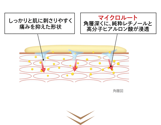 角層図　しっかりと肌に刺さりやすく痛みを抑えた形状　マイクロルート：角層深くに、純粋レチノールと高分子ヒアルロン酸が浸透