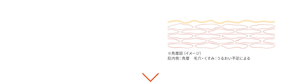 ※角層図（イメージ） 肌内側：角層　毛穴・くすみ：うるおい不足による