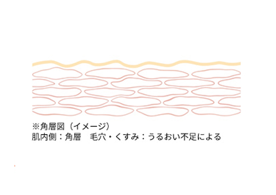肌内側のハリ・弾力、 肌表面のうるおい・毛穴・キメ・くすみが 気になる肌に ※角層図（イメージ） 肌内側：角層　毛穴・くすみ：うるおい不足による