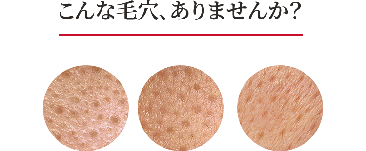 こんな毛穴、ありませんか？