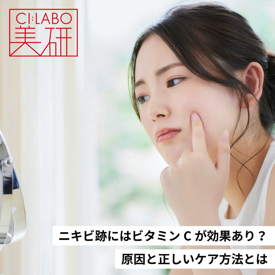 ニキビ跡にはビタミンCが効果あり？原因と正しいケア方法とは
