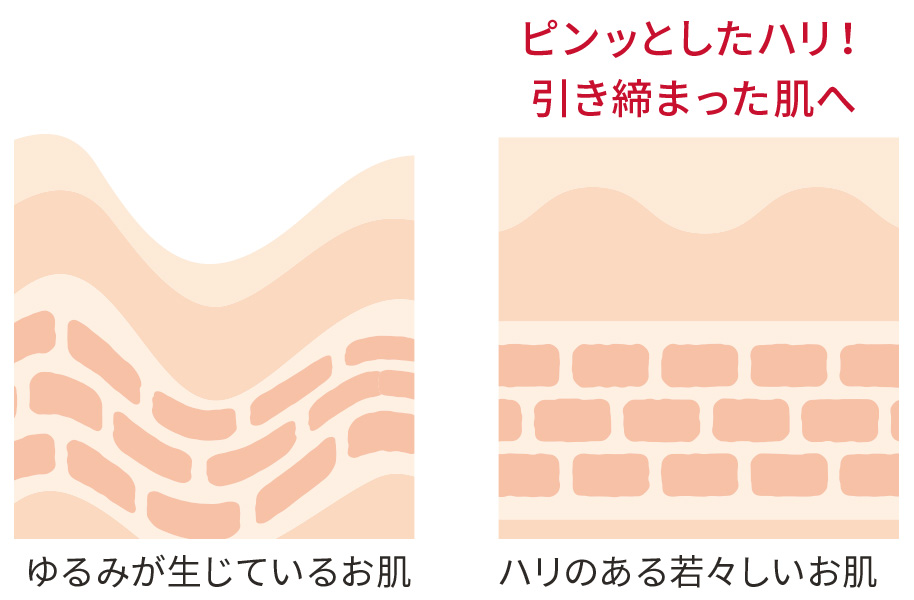 ゆるみが生じているお肌 ピンッとしたハリ!引き締まった肌へ