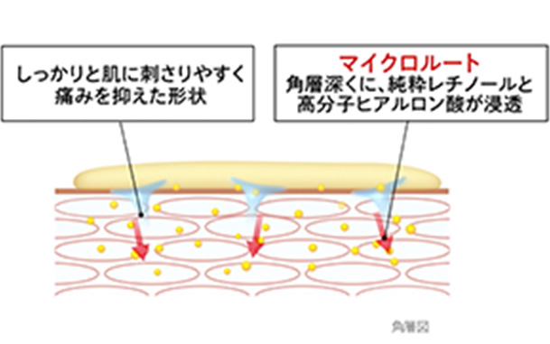 しっかり肌に刺さりやすく痛みを抑えた形状　マイクロルート　角層深くに、純粋レチノールと高分子ヒアルロン酸が浸透