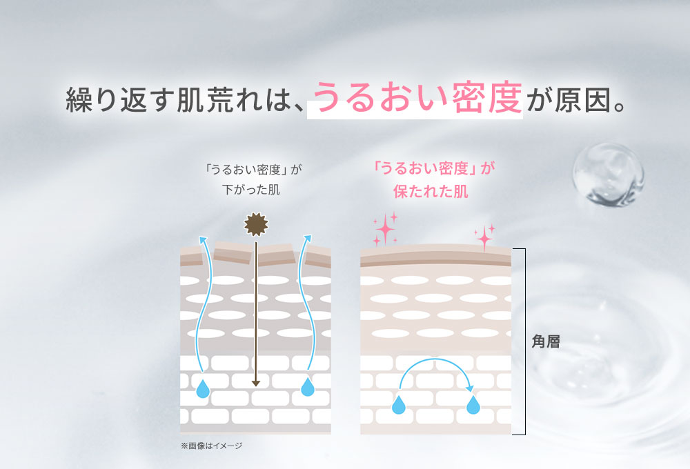 繰り返す肌荒れは、うるおい密度が原因
