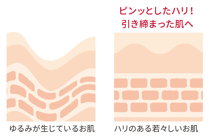 ゆるみが生じているお肌　ピンッとしたハリ！引き締まった肌へ