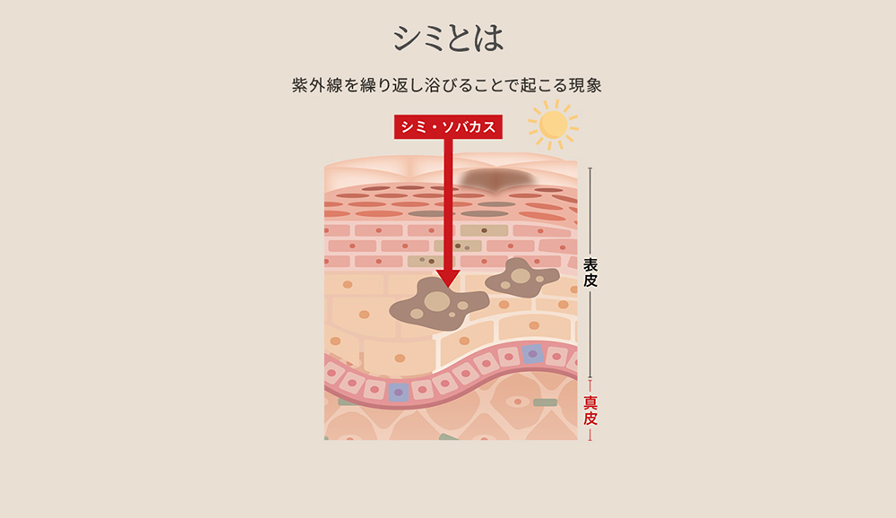 
  シワとは　コラーゲン減少により、シワが表面化