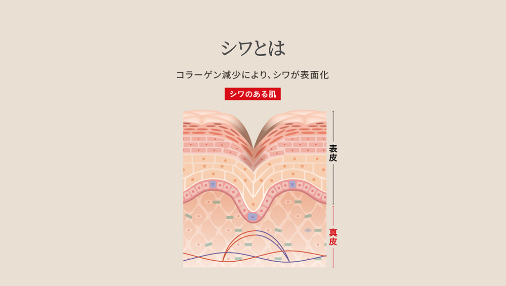 
  シミとは　紫外線を繰り返し浴びることで起こる現象