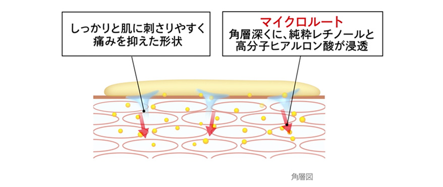 しっかり肌に刺さりやすく痛みを抑えた形状　マイクロルート　角層深くに、純粋レチノールと高分子ヒアルロン酸が浸透